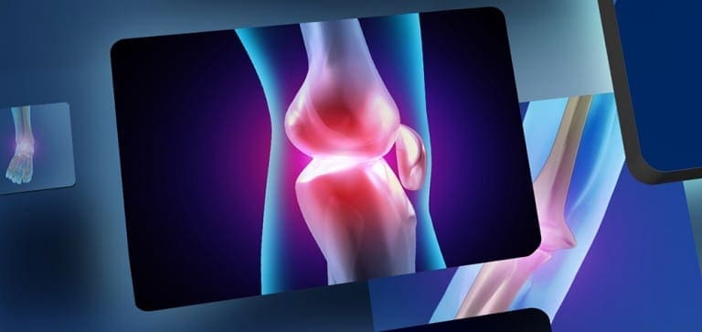 Joint adventures: The path to total knee replacement