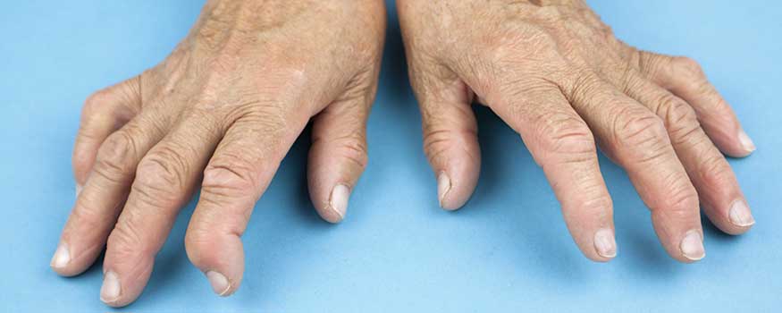 The 6 Best Exercise Equipment for Hand Arthritis