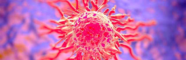 endometrial cancer