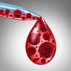 fda treatment erdheim chester disease cancer blood