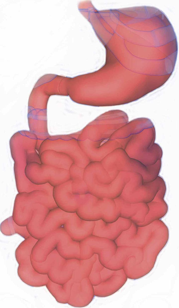 dumping syndrome cause management patient education ant