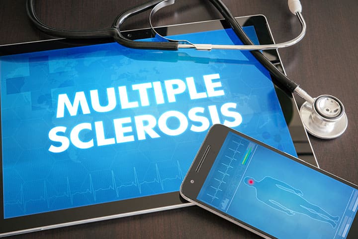 multiple sclerosis fatigue patient