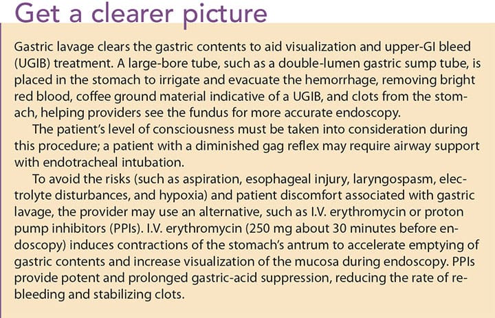 stop acute upper gi bleed clear picture