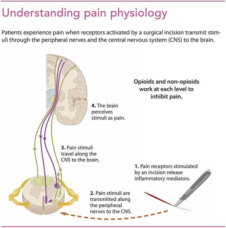 opioid non-opioid analgesia surgery understand pain physiology