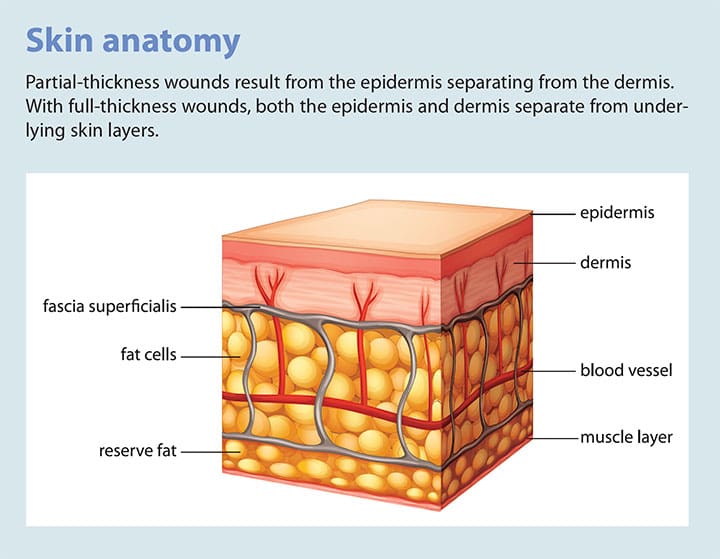 tear assessment management prevention skin anatomy