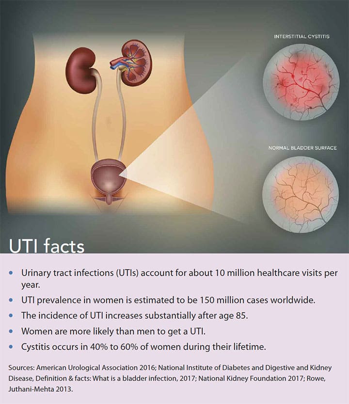 Diagnosis, treatment, and prevention of cystitis