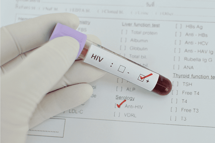 antibody therapy hiv patients