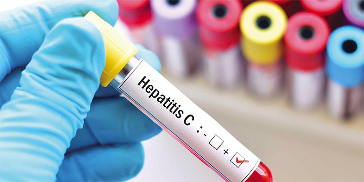 screening management hepatitis-c