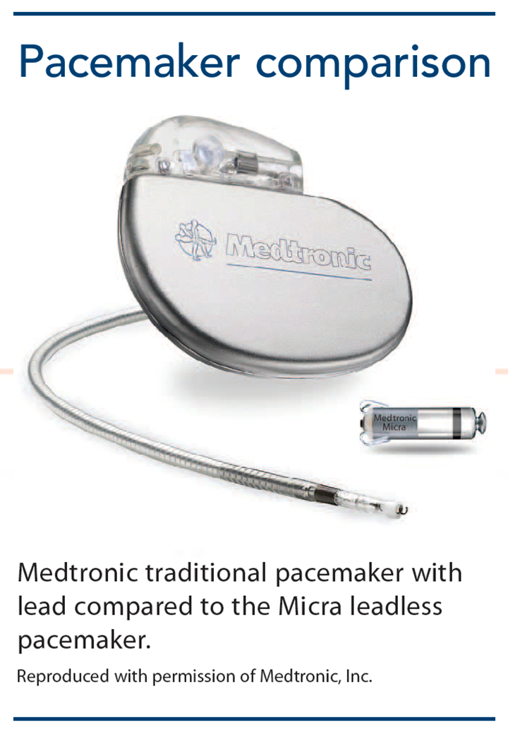 leadless pacemakers cardiac pacing comparison