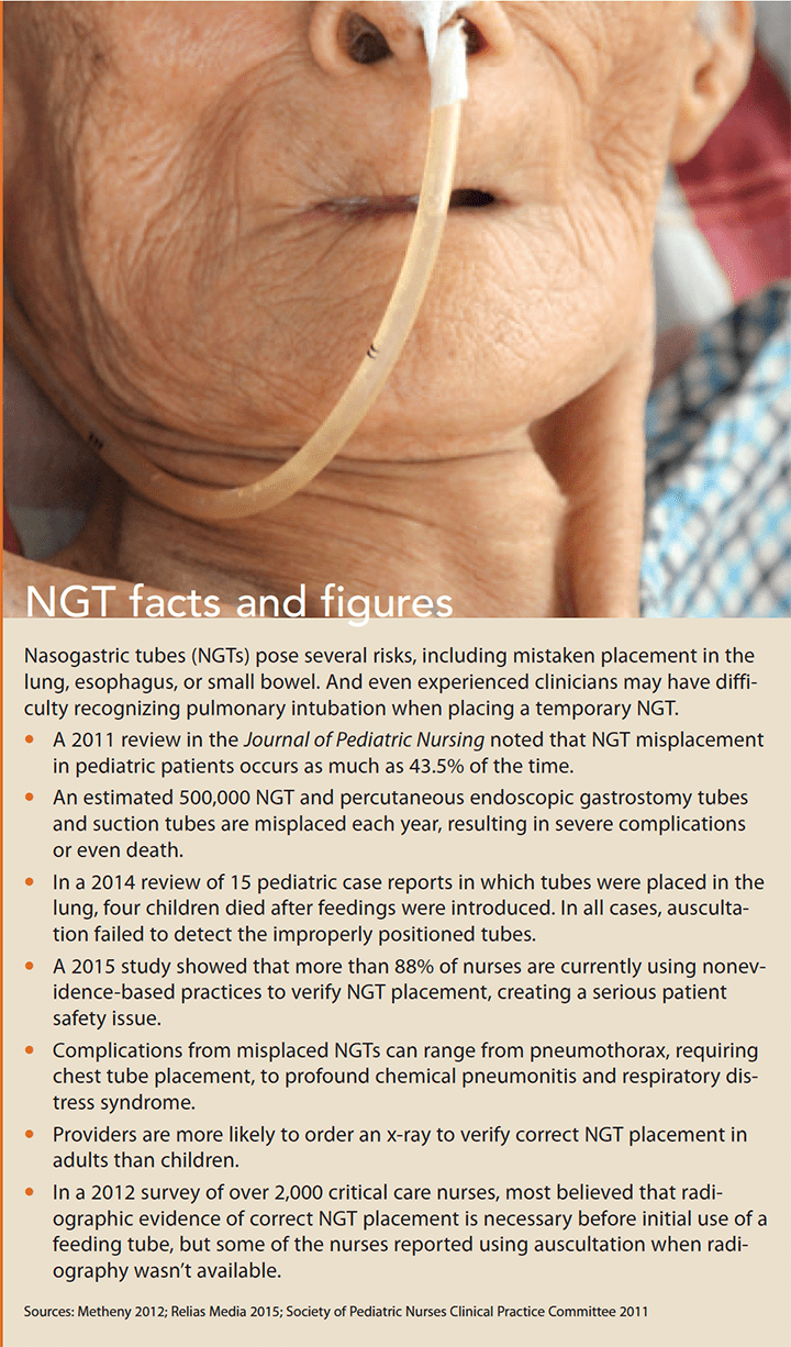 reducing nasogastric tube misplacement facts figures