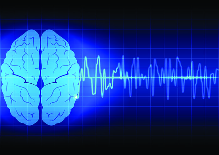 Seizure Alert Technology - Epilepsy WA