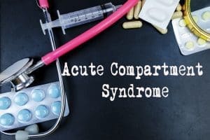 Acute,Compartment,Syndrome,Word,,Medical,Term,Word,With,Medical,Concepts