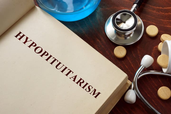 Acute hypopituitarism, healthcare, registered nurse, nursing, nursing journal